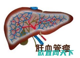 氯乙烯所致肝血管肉瘤